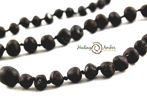 *Healing Amber - 13" Amber Infant/Child Necklace